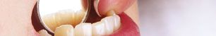 Kranke Zähne & Behandlung
